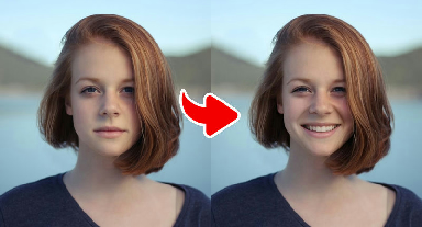 Example result of the Classic White Teeth Smile – Bright & Fresh effect
