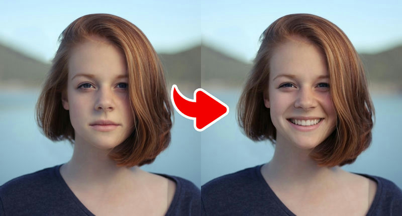 Classic White Teeth Smile – Bright & Fresh